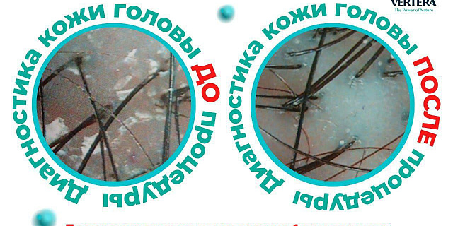 Эстетическая трихология